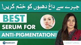 Best Serum For Anti Pigmentation | Chehre Ke Dag Dhabon Ka Ilaj | Pigmentation Treatment