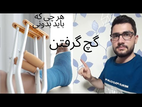 تصویری: 4 روش برای تفریح با پای شکسته