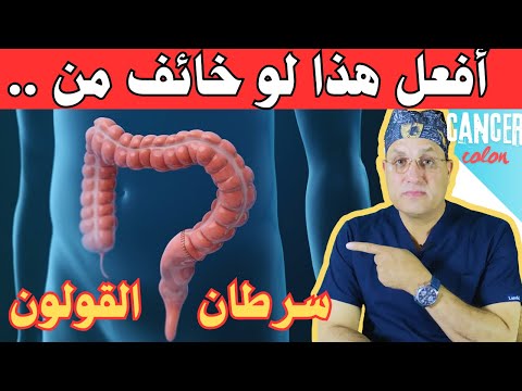 هذا الفحص يخبرك اذا كان لديك سرطان ام لا كل ما تريد معرفته عن فحوصات سرطان القولون