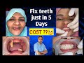 Full mouth dental implant case and cost  implant with teeth in 5 days only