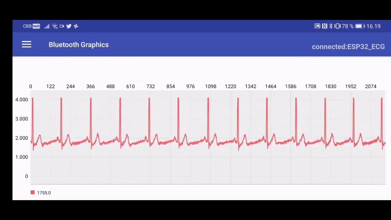 ESP32 AD8232 Arduino Bluetooth ECG simple YouTube esp32-ad8232-arduino-bluetooth-ecg-simple-youtube