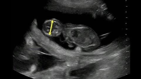 How to measure fetal age with an ultrasound machine on dogs