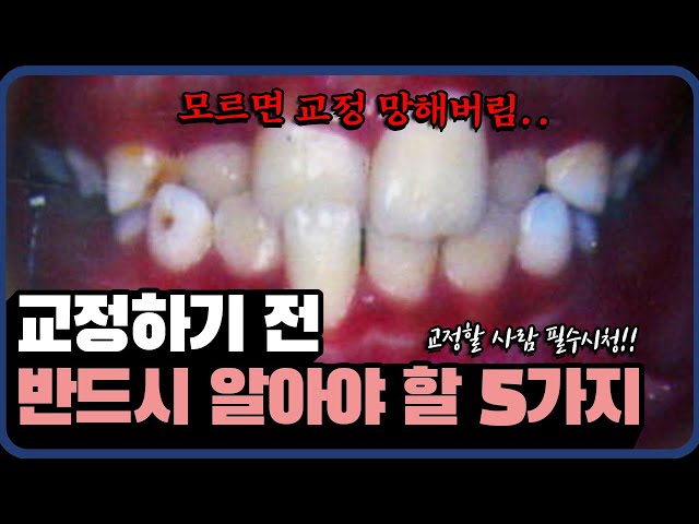 ()교정 전 필수 TOP5 ㅣ 교정 전문 원장이 알려드립니다..!