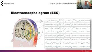 Essex BCI-NE webinars: Reinhold Scherer - Learning to Learn
