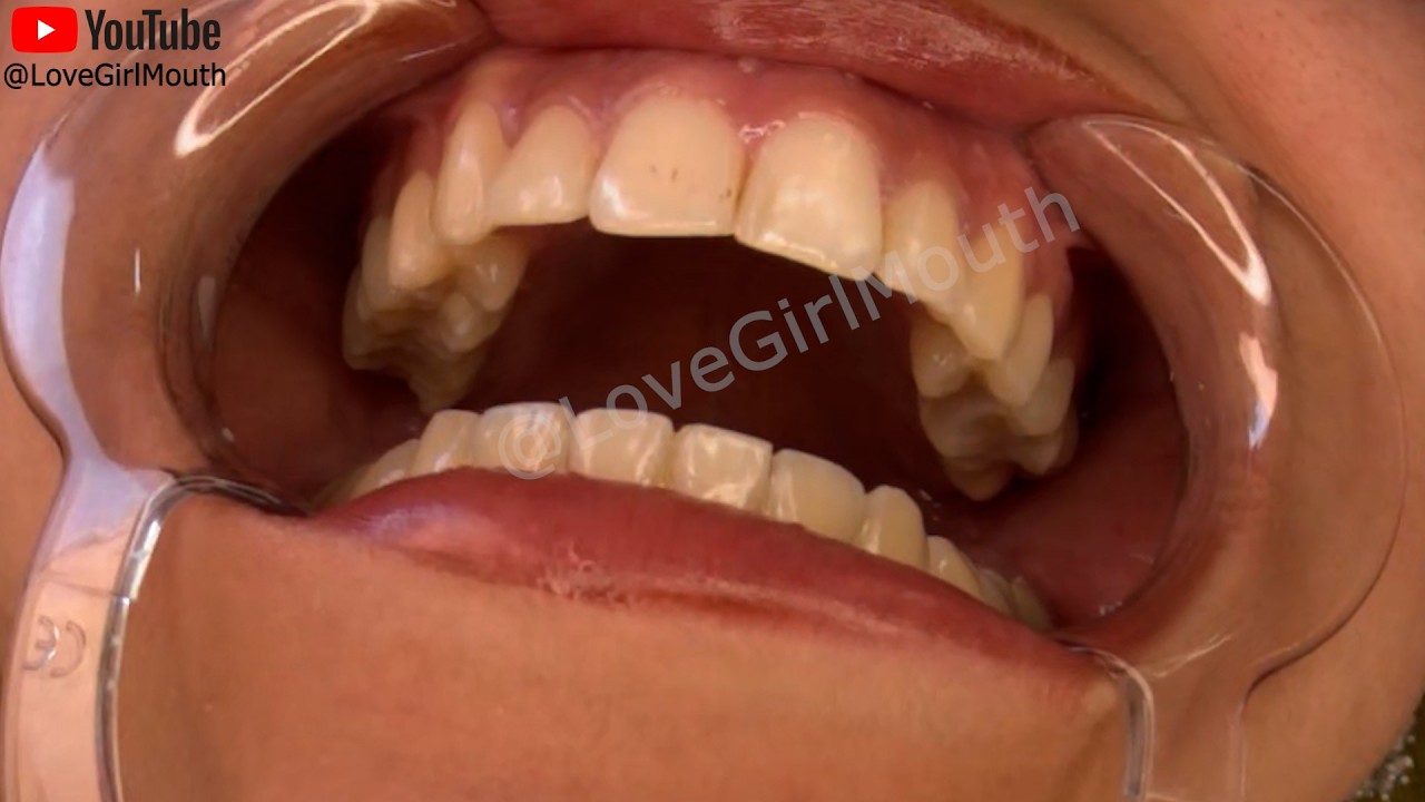 Girl mouth tour shows her great teeth Girl uses a mouth opener, mouth spreader to show her teeth