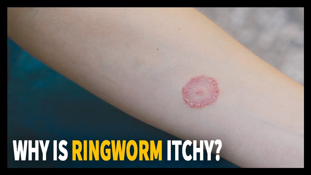 how do you know ringworm is healing in dogs
