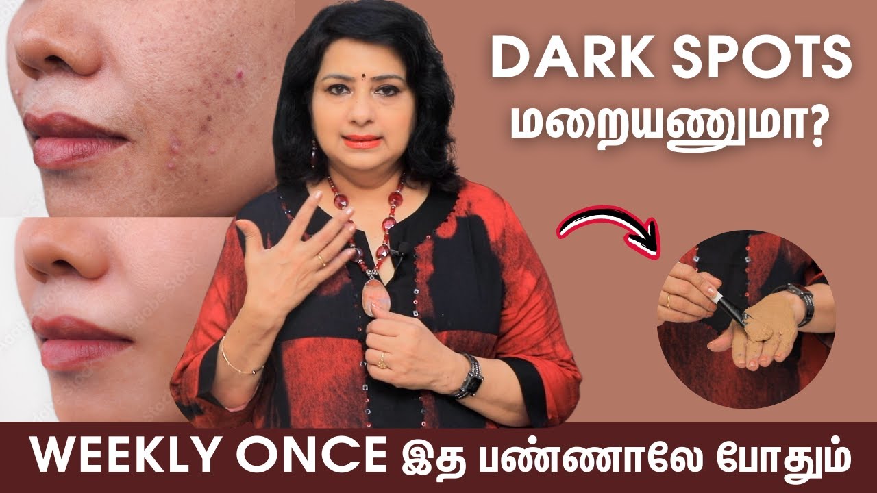 Social Media-வ பாத்து உங்க Skin-அ Damage பண்ணிக்காதீங்க! - Beautician Vasundhara | Summer Skin Care