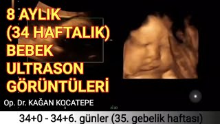 34+0 haftalık gebelikte (8 aylık hamilelik) anne karnında bebeğe ait ultrasonografi görüntüleri Resimi