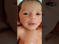 is video per 100 milian views Jana chahie #babychoice #baby #cuteanimal #neonatologist