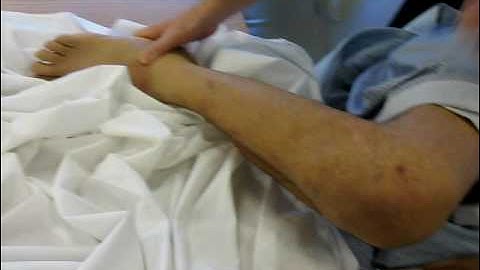 Quadriplegic, Masi Sala, straightens left leg