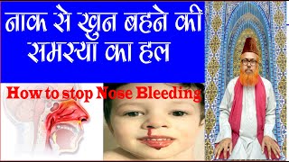 Treatment of Nose Bleeding ll naksir rokne ka upay ll How to stop nose bleeding ll Nose Bleeding