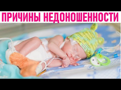 СРОК ПРЕЖДЕВРЕМЕННЫХ РОДОВ | Рождение недоношенного ребенка причины