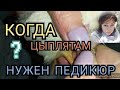 Что это на Лапах у Цыплят?/Чем кормлю и Пропаиваю Цыплят?/Куры Леггорн//Balls on chicks feet.