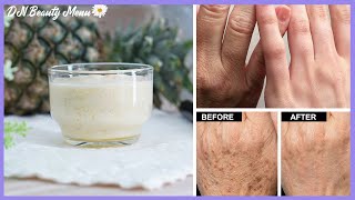 ✨Younger Hands✨ Menu 2: चिकना और मुलायम हाथ, हाथों की झुर्रियों को कम करें हाथों पर हुए काले धब्बे। screenshot 2