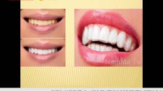 NAMMA TV - HELLO IDA TALK SHOW, DR HARISH SHETTY, TOPIC: "MANAGEMENT OF DISCOLORED TEETH" screenshot 4