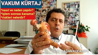 Kürtaj (vakumlu) nasıl yapılır? Riskli mi? Ağrı, kanama, kısırlık yapar mı? İlk adet ne zaman olur? Resimi