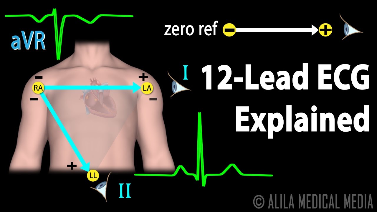 12 Lead ECG Explained Animation