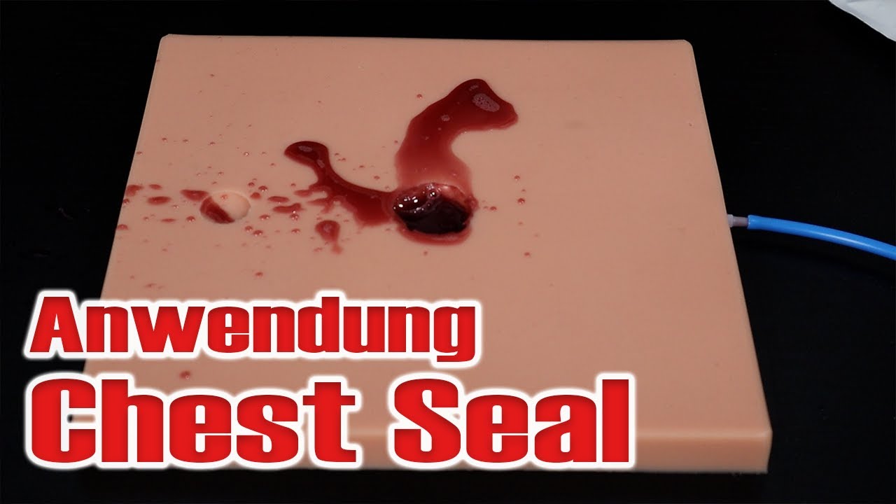 Anwendung eines Chest Seal | Sanitäter Basics