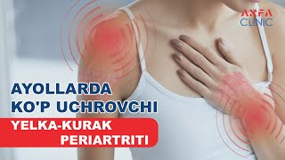 Ayollarda ko'p uchrovchi yelka-kurak periartriti