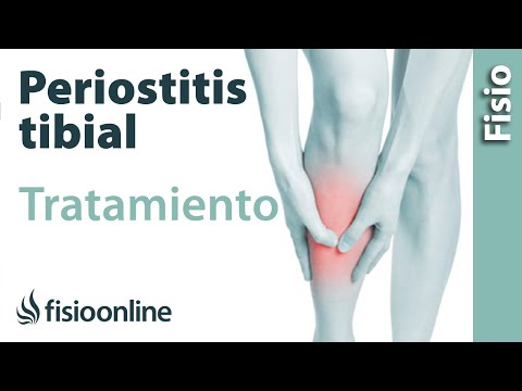 Vídeo: Por que dor tibial anterior?