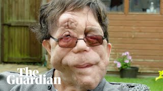 'Actors don't black up, so why do they still crip up?'