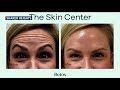 The skin center new day cleveland