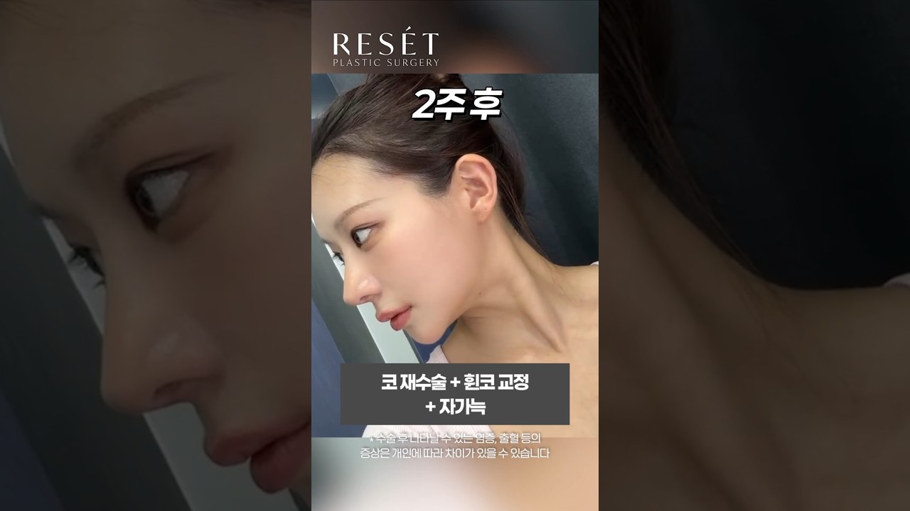 등록한썸네일
