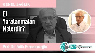 El Yaralanmaları Nelerdir?