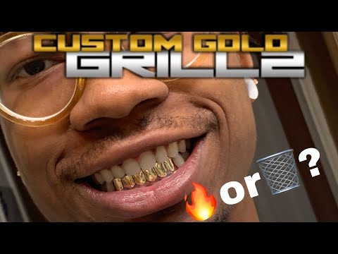 How to spot fake gold grillz