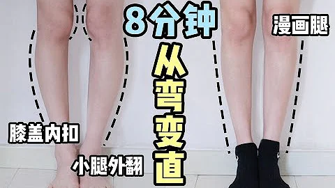 【Valgus Correction Of Leg】8分钟矫正小腿外翻、肌肉粗壮，轻松拥有细长直漫画腿 | 分析小腿外翻成因 & 动作讲解 | 掰直O型腿！ - 天天要闻