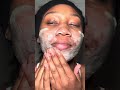 Eczema Prone Sensitive Skin This Changed Everything Eczema Prone Sensitive Skin This Changed Everything