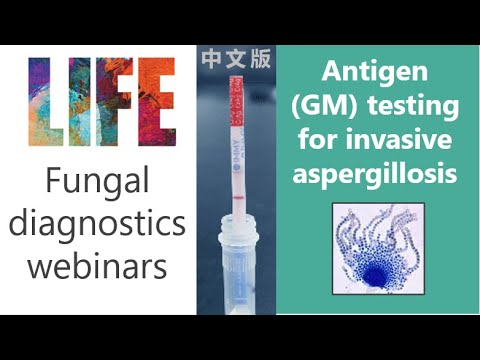 Video: Aspergillus Precipitin Test: Příprava, Rizika A Výsledky