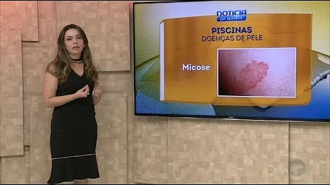 Come sono i funghi da piscina?