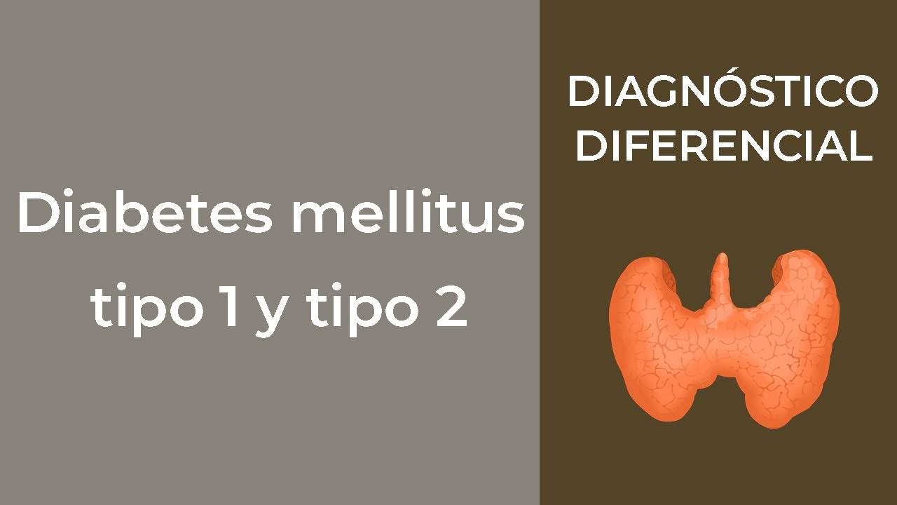 Diagnóstico Diferencial. Diabetes mellitus tipo 1 y tipo 2