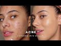 HOW TO: COVER ACNE WITH MAKEUP (BASE ROUTINE)