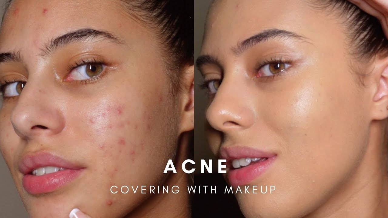 How To Er Acne With Makeup Base