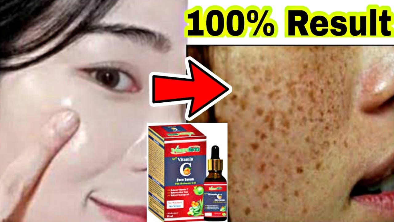 चेहरे पर आएगा इंस्टेंट निखार रंग होगा साफ़|TreasureHerbs Vitamin C & Hyaluronic Skin Whitening Serum