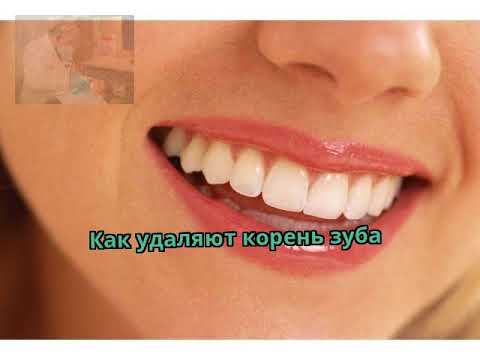 Как удаляют корень зуба