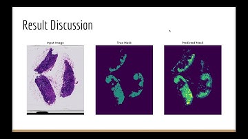 Applied Deep Learning Project - Detecting Cancer in Gigapixel Pathology Images