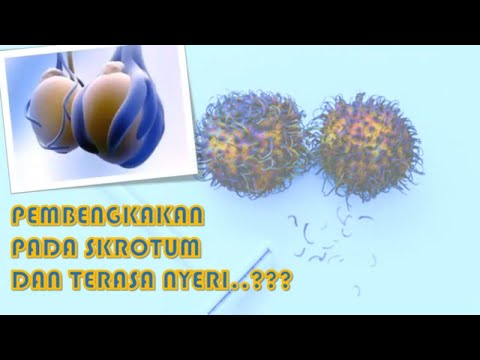 Video: Penyebaran Serotipe Virus Yang Berkaitan Dengan Adeno Dalam Testis Tetikus