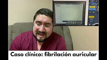 ¿Qué no se debe hacer en caso de fibrilación auricular?