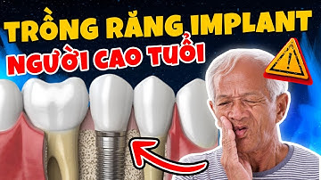 3 Lưu Ý Cực Quan Trọng Khi Trồng Răng Implant Cho Người Cao Tuổi (Liên Quan Trực Tiếp Đến Tính Mạng)