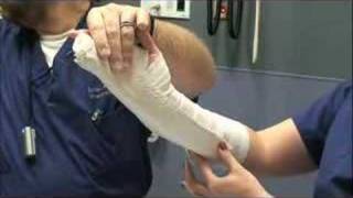 Ulnar Gutter Splint