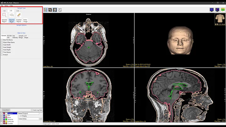 Analyze 14.0 - Measure: 2D Selected Object