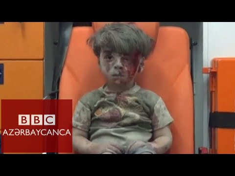 Ürəkləri parçalayan görüntülər: Suriyada 5 yaşlı Omran Daqniş