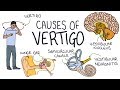 Understanding the causes of vertigo