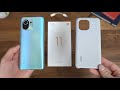 Xiaomi Mi 11 Unboxing!