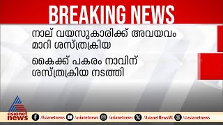 നാവിന്റെ ശസ്ത്രക്രിയ കഴിഞ്ഞ് അരമണിക്കൂറിനുള്ളിൽ അടുത്ത ശസ്ത്രക്രിയ