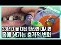 혈중 탄산 농도 초초초초과다 주의!!! 33년간 물 대신 탄산을 마셔온 남자 | Excessive Concentrations of SODA in His Blood!