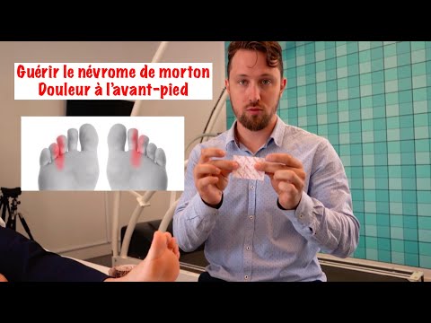 Vidéo: Névrome De Morton: Causes, Traitement Et Plus